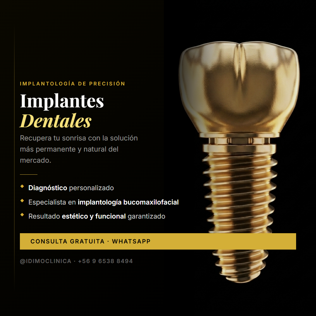 Implantes dentales IDIMO — Solución permanente