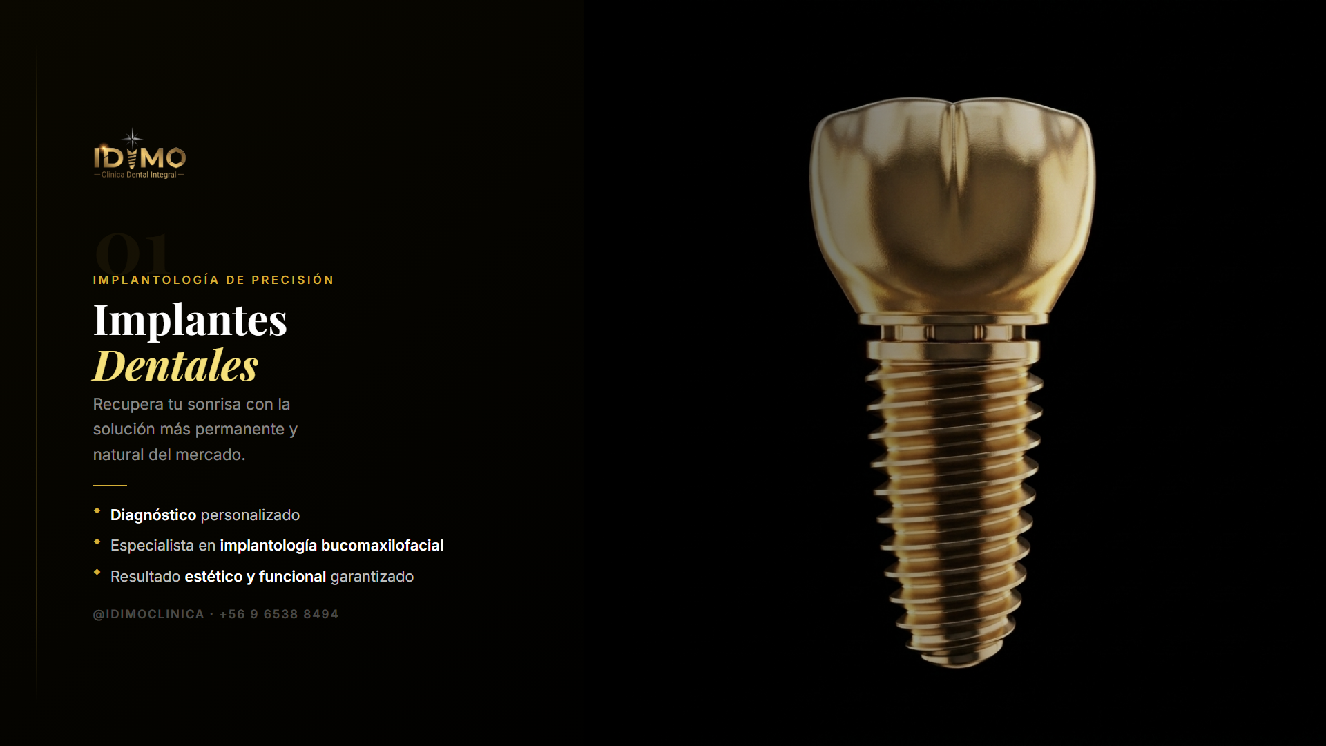 Implantes dentales IDIMO — Solución permanente