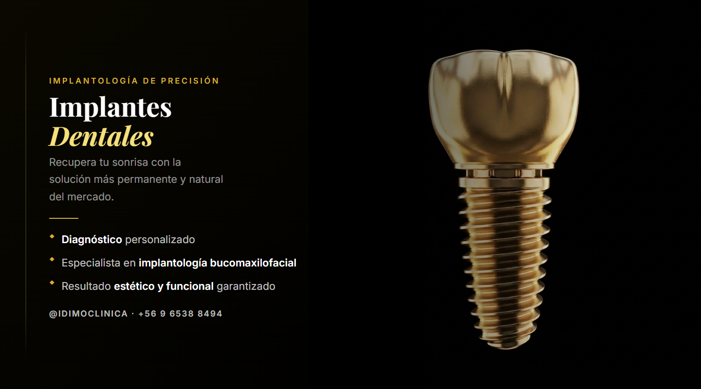 Implantes dentales IDIMO — Solución permanente
